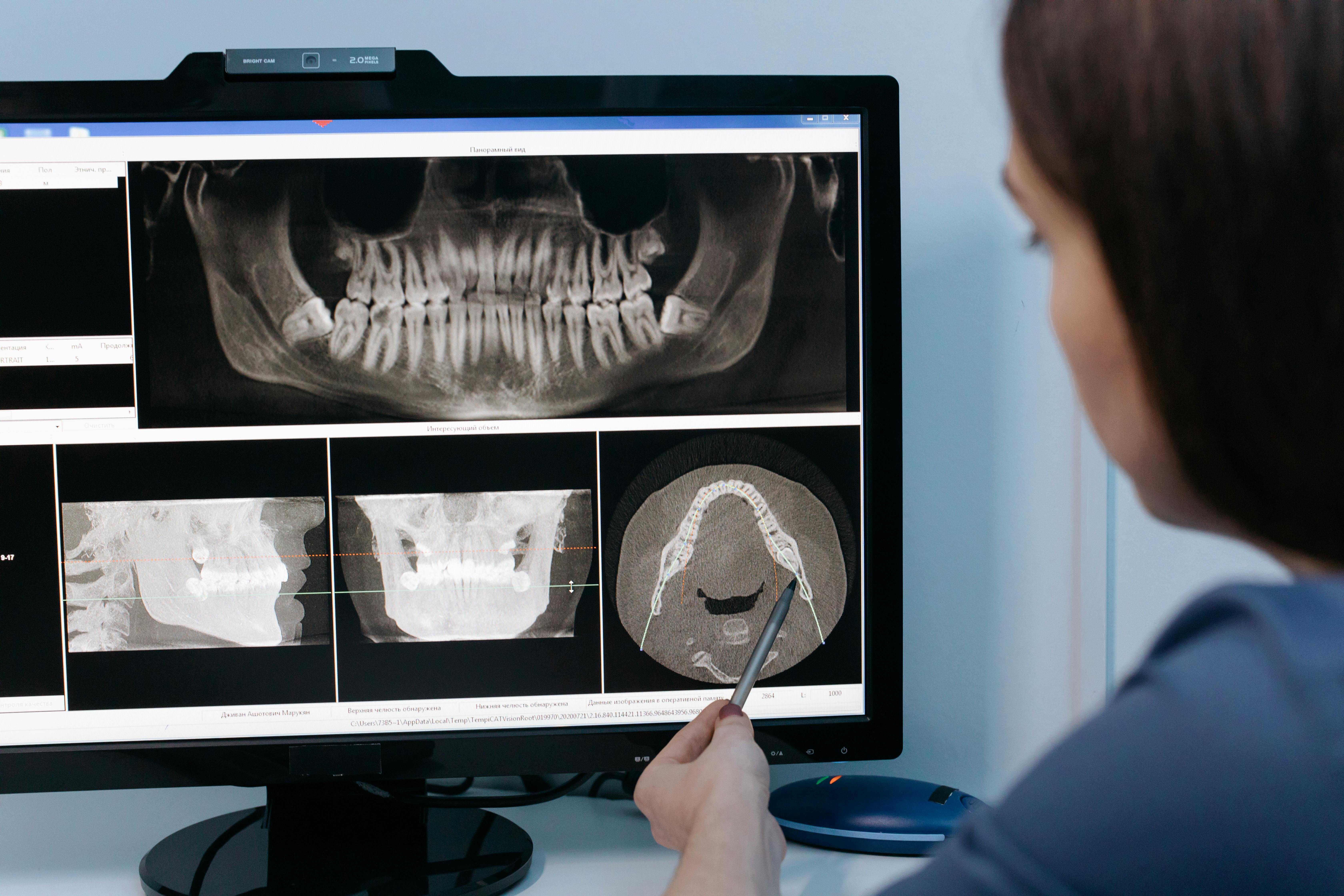 ROI Calculators for Dental Practices